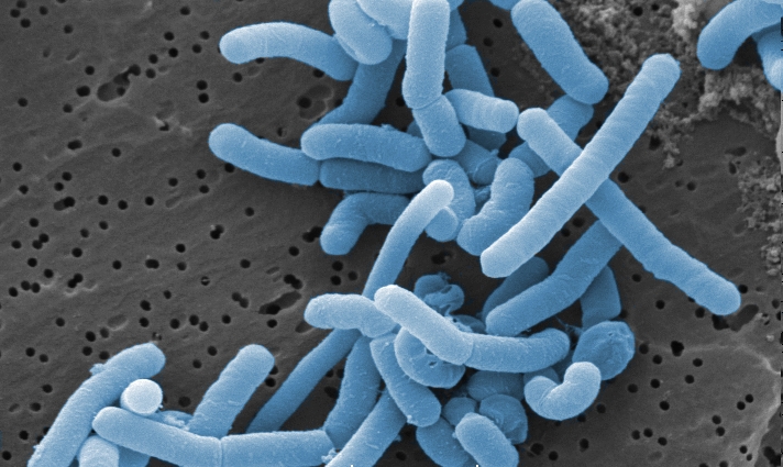 Lactobacillus Paracasei